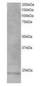 VPS28 Subunit Of ESCRT-I antibody, orb18629, Biorbyt, Western Blot image 