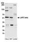 Lamina-associated polypeptide 2, isoform beta antibody, A304-841A, Bethyl Labs, Western Blot image 