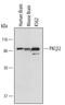 Protein Kinase C Beta antibody, AF4378, R&D Systems, Western Blot image 