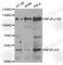 Nuclear Factor Kappa B Subunit 2 antibody, A5567, ABclonal Technology, Western Blot image 