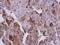Ubiquitin Conjugating Enzyme E2 T antibody, NBP2-20789, Novus Biologicals, Immunohistochemistry paraffin image 