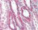 Salt Inducible Kinase 2 antibody, 49-319, ProSci, Immunohistochemistry paraffin image 