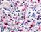 Cyclin Dependent Kinase 12 antibody, LS-A7320, Lifespan Biosciences, Immunohistochemistry paraffin image 