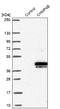 Charged multivesicular body protein 4b antibody, NBP1-91782, Novus Biologicals, Western Blot image 