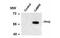 Tryptophan Hydroxylase 2 antibody, MBS835065, MyBioSource, Western Blot image 