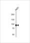 Desmocollin 3 antibody, 58-711, ProSci, Western Blot image 