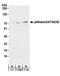 Transcriptional repressor p66-beta antibody, A301-281A, Bethyl Labs, Western Blot image 