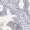Myomesin 2 antibody, PA5-51632, Invitrogen Antibodies, Immunohistochemistry paraffin image 