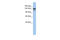 SPT5 Homolog, DSIF Elongation Factor Subunit antibody, 25-181, ProSci, Western Blot image 