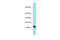 Late Cornified Envelope 3C antibody, A08457, Boster Biological Technology, Western Blot image 