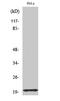 Translocase Of Outer Mitochondrial Membrane 20 antibody, STJ96061, St John