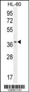 Zinc finger protein 322B antibody, 55-824, ProSci, Western Blot image 