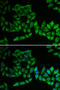 Thiopurine S-Methyltransferase antibody, STJ25944, St John