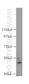 Betaine--Homocysteine S-Methyltransferase antibody, 15965-1-AP, Proteintech Group, Western Blot image 