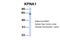 Karyopherin Subunit Alpha 1 antibody, NBP1-54604, Novus Biologicals, Western Blot image 