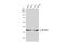 Methylenetetrahydrofolate Dehydrogenase (NADP+ Dependent) 2, Methenyltetrahydrofolate Cyclohydrolase antibody, GTX104990, GeneTex, Western Blot image 