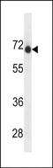 Endonuclease Domain Containing 1 antibody, PA5-49244, Invitrogen Antibodies, Western Blot image 