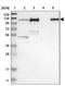 KN motif and ankyrin repeat domain-containing protein 2 antibody, NBP1-89080, Novus Biologicals, Western Blot image 