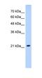 Solute Carrier Family 25 Member 14 antibody, orb325096, Biorbyt, Western Blot image 