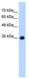 GABA(A) receptor subunit gamma-2 antibody, TA338795, Origene, Western Blot image 