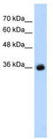 Gamma-Aminobutyric Acid Type A Receptor Gamma2 Subunit antibody, TA338795, Origene, Western Blot image 