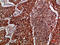 IMP-3 antibody, A03007, Boster Biological Technology, Immunohistochemistry frozen image 