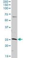 Adenylate Kinase 3 antibody, H00050808-D01P, Novus Biologicals, Western Blot image 