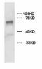 Protein Tyrosine Phosphatase Non-Receptor Type 11 antibody, LS-C171883, Lifespan Biosciences, Western Blot image 