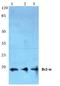 BCL2L2-PABPN1 Readthrough antibody, PA5-75315, Invitrogen Antibodies, Western Blot image 