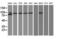 Protein Kinase C Epsilon antibody, LS-C172674, Lifespan Biosciences, Western Blot image 