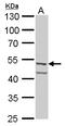 Fascin Actin-Bundling Protein 1 antibody, GTX117805, GeneTex, Western Blot image 