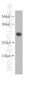 Metabolism Of Cobalamin Associated B antibody, 11137-1-AP, Proteintech Group, Western Blot image 