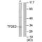 General transcription factor IIE subunit 2 antibody, PA5-49798, Invitrogen Antibodies, Western Blot image 