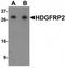 Hepatoma-derived growth factor-related protein 2 antibody, TA320056, Origene, Western Blot image 