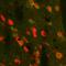 Proenkephalin-A antibody, A07495, Boster Biological Technology, Western Blot image 