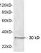 Thiopurine S-Methyltransferase antibody, LS-B14110, Lifespan Biosciences, Western Blot image 