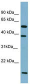 Solute Carrier Family 10 Member 1 antibody, TA346341, Origene, Western Blot image 