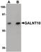 Polypeptide N-Acetylgalactosaminyltransferase 10 antibody, PA5-20785, Invitrogen Antibodies, Western Blot image 