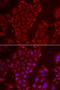 Tripeptidyl Peptidase 2 antibody, LS-C334705, Lifespan Biosciences, Immunofluorescence image 