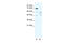 E3 ubiquitin-protein ligase TRIM23 antibody, 28-782, ProSci, Western Blot image 