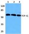 Chaperonin Containing TCP1 Subunit 6A antibody, PA5-37073, Invitrogen Antibodies, Western Blot image 