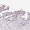Hexosaminidase Subunit Beta antibody, NBP2-49211, Novus Biologicals, Immunohistochemistry paraffin image 