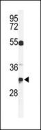 Tetraspanin 7 antibody, MBS9206828, MyBioSource, Western Blot image 