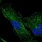 Transmembrane Protein 200C antibody, NBP2-30838, Novus Biologicals, Immunofluorescence image 