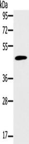 Potassium Voltage-Gated Channel Subfamily J Member 15 antibody, TA351600, Origene, Western Blot image 