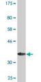 Mesencephalic Astrocyte Derived Neurotrophic Factor antibody, H00007873-M01, Novus Biologicals, Western Blot image 