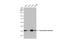 Thymidylate Synthetase antibody, GTX636636, GeneTex, Western Blot image 