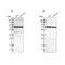Leucine Rich Repeat Containing 47 antibody, NBP1-93598, Novus Biologicals, Western Blot image 