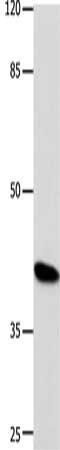 POU Class 5 Homeobox 1 antibody, CSB-PA550936, Cusabio, Western Blot image 