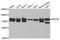 NDC80 Kinetochore Complex Component antibody, A5411, ABclonal Technology, Western Blot image 